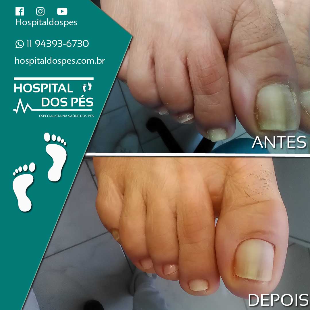 Doctor Feet Super Shopping Osasco - Doctor Feet Podologia