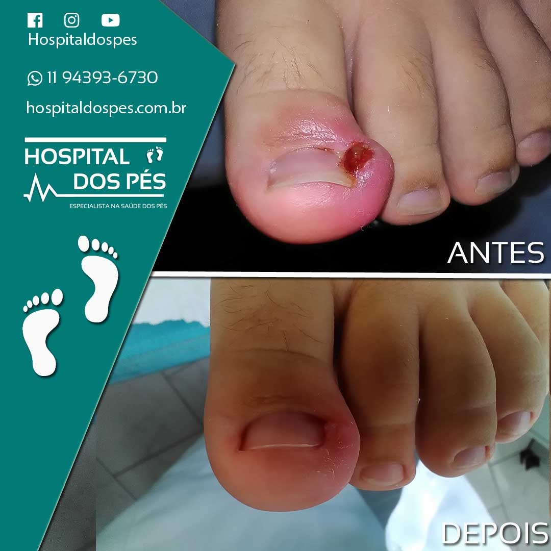 Doctor Feet Super Shopping Osasco - Doctor Feet Podologia